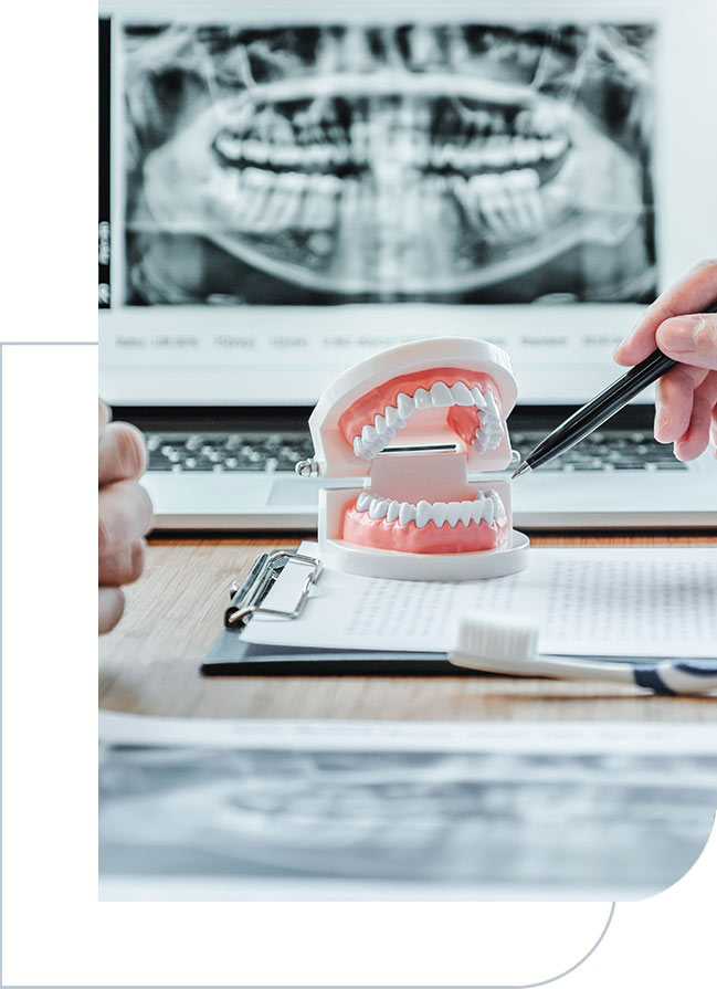 a hand holding a pen over a model of a jaw